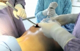 Gluteoplastia de aumento con implantes: vías de abordaje y plano de colocación